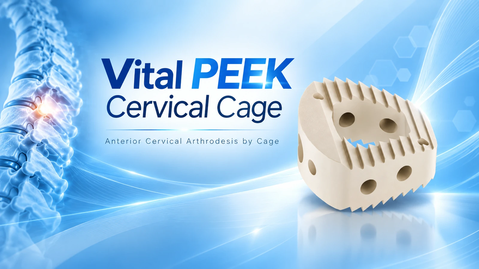 Vital PEEK Cervical Cage