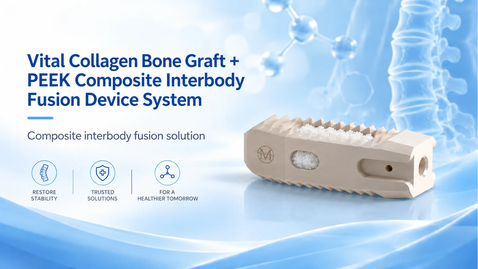 Vital Collagen Bone Graft + PEEK Composite Interbody Fusion Device System