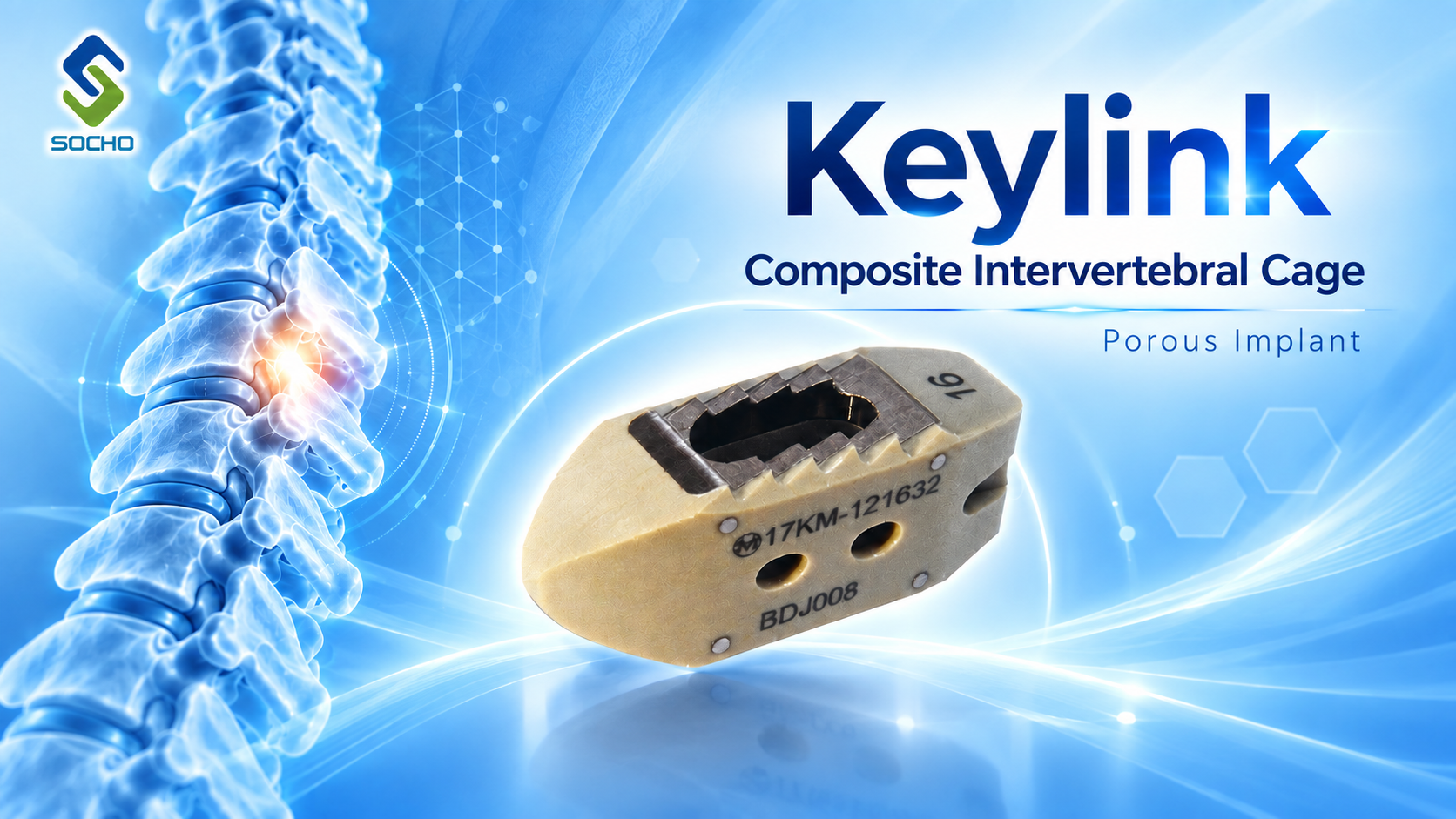 Keylink Composite Intervertebral Cage
